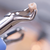 A tooth in a set of pliers